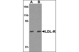 Western blot analysis of LDL-R in human liver tissue lysate with this product at (A) 1 and (B) 2 μg/ml. (LDLR Antikörper  (Center))