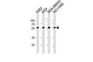 Western Blotting (WB) image for anti-Nuclear Pore Complex Interacting Protein-Like 2 (NPIPL2) antibody (ABIN3004718) (NPIPL2 Antikörper)