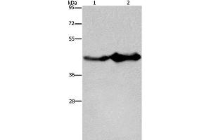 Western Blot analysis of Mouse liver and brain tissue using GLUL Polyclonal Antibody at dilution of 1:600 (GLUL Antikörper)
