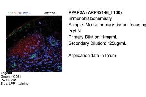 Sample Type: Mouse primary tissue, focusing in pLNPrimary Dilution: 1mg/mLSecondary Dilution: 125ug/mL (PPAP2A Antikörper  (Middle Region))