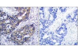 Immunohistochemistry (IHC) image for anti-Insulin Receptor Substrate 1 (IRS1) (Ser312) antibody (ABIN1848112) (IRS1 Antikörper  (Ser312))