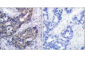 Immunohistochemistry (IHC) image for anti-Insulin Receptor Substrate 1 (IRS1) (Ser312) antibody (ABIN1848113) (IRS1 Antikörper  (Ser312))