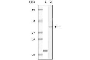Western blot analysis using CIB1 mouse mAb against truncated CIB1 recombinant protein (1) and A431 cell lysate (2).