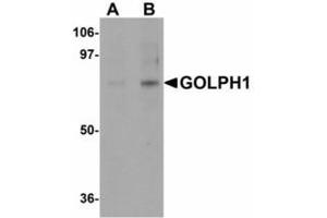Image no. 1 for anti-Acyl-CoA Binding Domain Containing 3 (Acbd3) (N-Term) antibody (ABIN478179) (ACBD3 Antikörper  (N-Term))