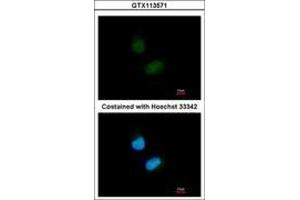 Image no. 2 for anti-Nuclear Receptor Subfamily 1, Group H, Member 2 (NR1H2) (AA 162-325) antibody (ABIN467613)