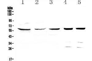 Western blot analysis of TCP1 eta using anti-TCP1 eta antibody . (CCT7 Antikörper  (AA 30-307))
