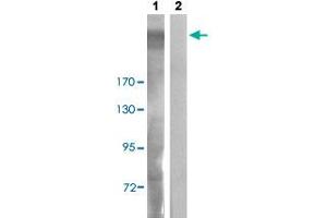 Western blot analysis of Lane 1: UV treated COS-7 cells, Lane 2: antigen-specific peptide treated COS-7 cells with IGF2R (phospho S2409) polyclonal antibody  at 1:500-1:1000 dilution. (IGF2R Antikörper  (pSer2409))