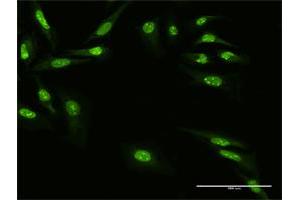 Immunofluorescence of purified MaxPab antibody to ZNF668 on HeLa cell. (ZNF668 Antikörper  (AA 1-619))