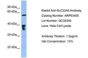 Image no. 1 for anti-Solute Carrier Family 22 Member 5 (SLC22A5) (C-Term) antibody (ABIN6749981) (SLC22A5 Antikörper  (C-Term))