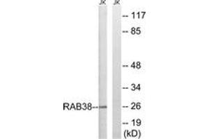 Western blot analysis of extracts from Jurkat cells, using RAB38 Antibody.