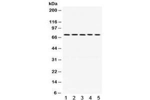 Western blot testing of 1) rat brain, 2) mouse stomach, human 3) HeLa, 4) U87 and 5) SKOV lysate with LIMK antibody.