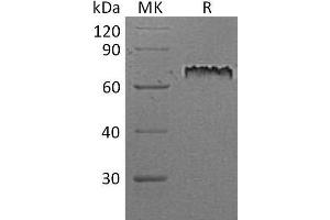 Western Blotting (WB) image for Notch 1 (NOTCH1) protein (His tag) (ABIN7320796) (Notch1 Protein (His tag))