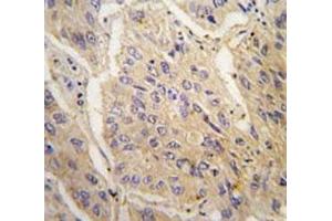 Immunohistochemistry (IHC) image for anti-Caspase 3 (CASP3) (AA 60-90) antibody (ABIN3030306)