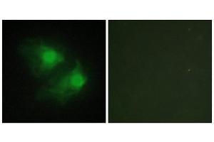 Immunofluorescence (IF) image for anti-LIM Domain Kinase 2 (LIMK2) (Internal Region) antibody (ABIN1849456) (LIMK2 Antikörper  (Internal Region))