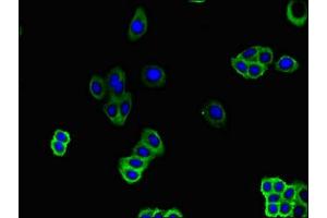 Immunofluorescent analysis of HepG2 cells using ABIN7162265 at dilution of 1:100 and Alexa Fluor 488-congugated AffiniPure Goat Anti-Rabbit IgG(H+L) (SLC51B Antikörper  (AA 57-128))