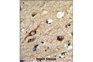 Formalin-fixed and raffin-embedded human brain tissue reacted with AGT3 Antibody (Center), which was peroxidase-conjugated to the secondary antibody, followed by DAB staining. (AGPAT3 Antikörper  (AA 241-269))