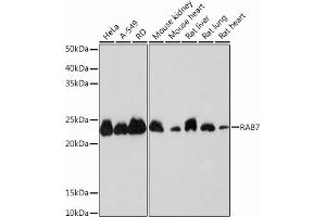 Western blot analysis of extracts of various cell lines, using R Rabbit mAb (ABIN7269812) at 1:1000 dilution. (RAB7A Antikörper)