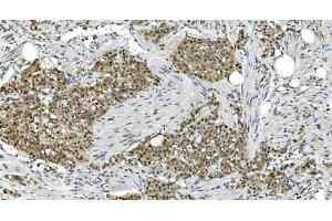 IHC analysis of LSM7 using anti-LSM7 antibody (ABIN7598937).