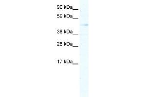 WB Suggested Anti-ARX Antibody Titration:  5. (Arx Antikörper  (Middle Region))