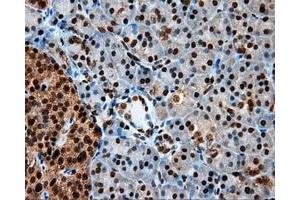 Immunohistochemical staining of paraffin-embedded colon tissue using anti-LTA4H mouse monoclonal antibody.