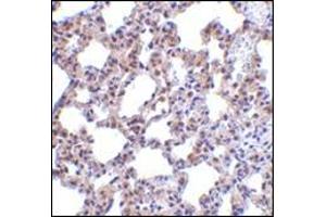 Immunohistochemistry of PKR in rat lung tissue with this product at 5 μg/ml. (EIF2AK2 Antikörper  (N-Term))