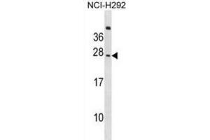 Western Blotting (WB) image for anti-CD300c (CD300C) antibody (ABIN2999034) (CD300c Antikörper)