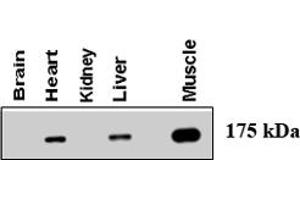 Western blot using AGL polyclonal antibody  at 1 : 500 dilution . (AGL Antikörper  (AA 1479-1510))