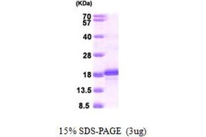 SDS-PAGE (SDS) image for Basic Leucine Zipper ATF-like Transcription Factor (BATF) (AA 1-125) protein (His tag) (ABIN667362)