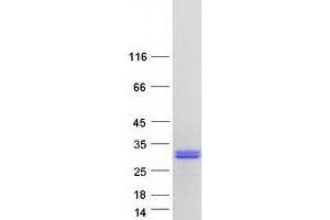 Validation with Western Blot (CT45A5 Protein (Transcript Variant 2) (Myc-DYKDDDDK Tag))