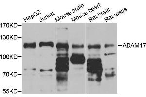 Western Blotting (WB) image for anti-ADAM Metallopeptidase Domain 17 (ADAM17) (C-Term) antibody (ABIN5663782) (ADAM17 Antikörper  (C-Term))