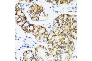 Immunohistochemistry of paraffin-embedded human stomach using CTNNA1 antibody. (CTNNA1 Antikörper  (AA 637-906))