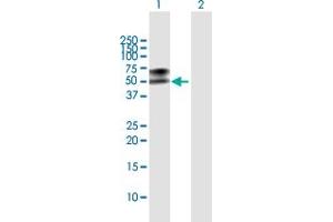 Western Blot analysis of LGMN expression in transfected 293T cell line by LGMN MaxPab polyclonal antibody. (LGMN Antikörper  (AA 1-433))