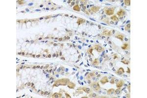 Immunohistochemistry of paraffin-embedded Human stomach using TRMT1 Polyclonal Antibody at dilution of 1:100 (40x lens). (TRMT1 Antikörper)