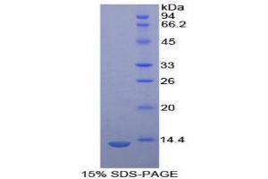 SDS-PAGE (SDS) image for Cystatin B (Stefin B) (CSTB) (AA 1-98) protein (His tag) (ABIN1079339)