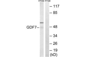Western Blotting (WB) image for anti-Growth Differentiation Factor 7 (GDF7) (Internal Region) antibody (ABIN1851392) (GDF7 Antikörper  (Internal Region))
