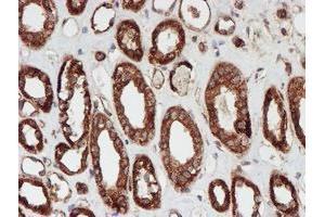 Immunohistochemical staining of paraffin-embedded Human Kidney tissue using anti-SCFD1 mouse monoclonal antibody. (SCFD1 Antikörper)