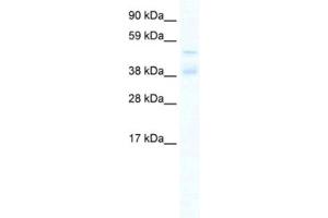 Western Blotting (WB) image for anti-Zinc Finger Protein 17 (ZNF17) antibody (ABIN2461332) (ZNF17 Antikörper)