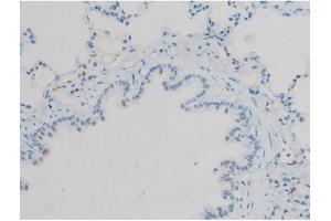 ABIN6267410 at 1/200 staining Rat lung tissue sections by IHC-P. (Connexin 43/GJA1 Antikörper  (pSer368))