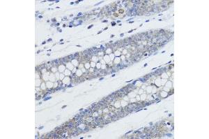Immunohistochemistry (IHC) image for anti-Histone H4 (meLys20) antibody (ABIN3016045)