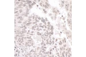 Immunohistochemistry (IHC) image for anti-Partner and Localizer of BRCA2 (PALB2) (AA 675-725) antibody (ABIN7454733) (PALB2 Antikörper  (AA 675-725))