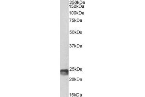 Biotinylated ABIN4902767 (1µg/ml) staining of Mouse Spleen lysate (35µg protein in RIPA buffer), exactly mirroring its parental non-biotinylated product. (SOCS1 Antikörper  (C-Term) (Biotin))