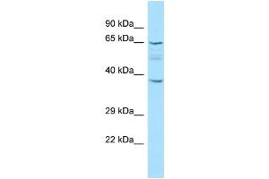 WB Suggested Anti-KRT77 Antibody Titration: 1.