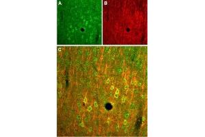 Expression of NMDA receptor 2B in rat cortex - Immunohistochemical staining of rat parietal cortex frozen sections stained with Anti-NMDAR2B (GluN2B) (extracellular) Antibody (ABIN7043230, ABIN7044326 and ABIN7044327), (1:100). (GRIN2B Antikörper  (Extracellular))