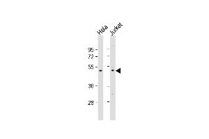 All lanes : Anti-ZN Antibody (N-term) at 1:1000 dilution Lane 1: Hela whole cell lysate Lane 2: Jurkat whole cell lysate Lysates/proteins at 20 μg per lane. (ZNF577 Antikörper  (N-Term))
