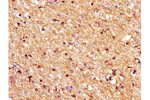 IHC image of ABIN7175545 diluted at 1:200 and staining in paraffin-embedded human brain tissue performed on a Leica BondTM system. (PROS1 Antikörper  (AA 42-676))