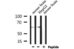 Western blot analysis of extracts from mouse brain and HepG2, using STIP1  Antibody. (STIP1 Antikörper  (N-Term))