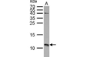 WB Image S100A11 antibody detects S100A11 protein by Western blot analysis. (S100A11 Antikörper)