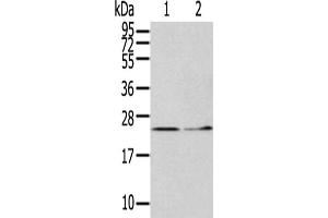 Gel: 12 % SDS-PAGE,Lysate: 40 μg,Lane 1-2: Hela cells, Human fetal liver tissue,Primary antibody: ABIN7127970(ITPA Antibody) at dilution 1/400 dilution,Secondary antibody: Goat anti rabbit IgG at 1/8000 dilution,Exposure time: 5 minutes (ITPA Antikörper)