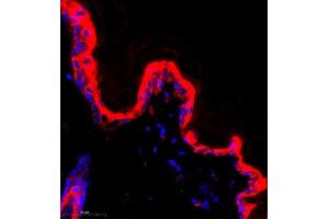 Immunofluorescence (Paraffin-embedded Sections) (IF (p)) image for anti-Keratin 13 (KRT13) (C-Term) antibody (ABIN7074411)