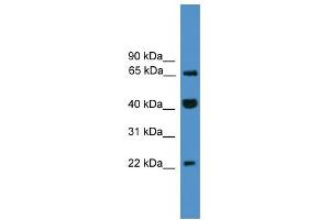 WB Suggested Anti-TCEAL6 Antibody Titration:  0.